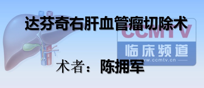 陈拥军：达芬奇右肝血管瘤切除术