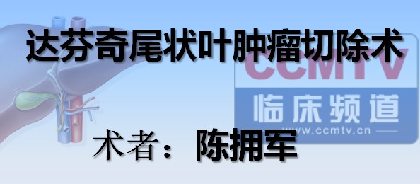 陈拥军：达芬奇尾状叶肿瘤切除术