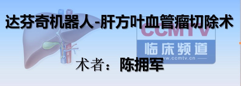 陈拥军：达芬奇机器人-肝方叶血管瘤切除术