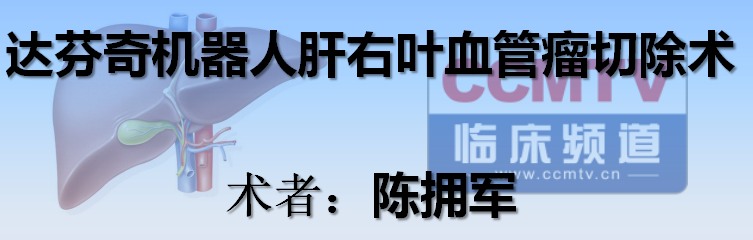 陈拥军：达芬奇机器人肝右叶血管瘤切除术