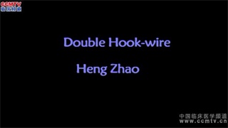 赵珩：DoubleHook-wire