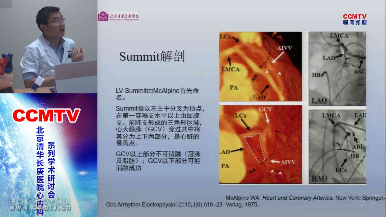 刘元伟：左室summit起源室性心律失常（VA）-心电图特点与消融