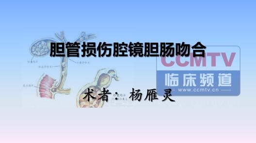 杨雁灵：胆管损伤腔镜胆肠吻合