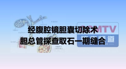 经腹腔镜胆囊切除术、胆总管探查取石一期缝合