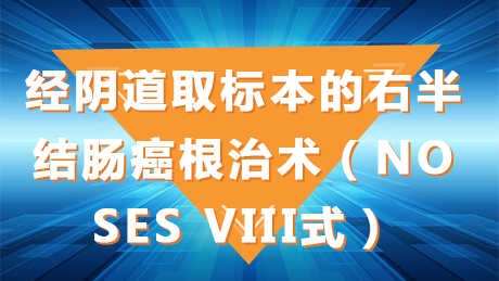 胡军红：经阴道取标本的右半结肠癌根治术NOSESVIII式