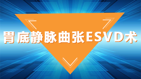 胃底静脉曲张ESVD术