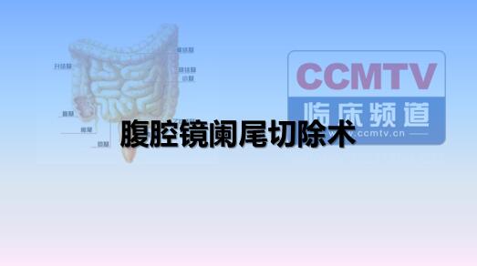腹腔镜阑尾切除术