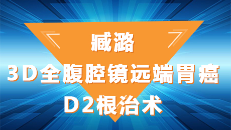 臧潞：3D全腹腔镜远端胃癌D2根治术