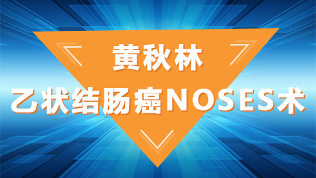 黄秋林：乙状结肠癌NOSES术