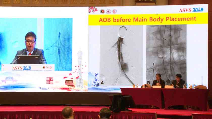 Management of ACS