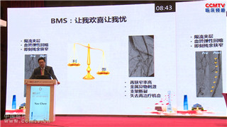 姚陈：-1+1-2-DBC与BMS联合应用治疗复杂性股腘动脉病变