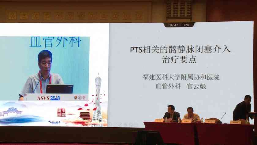 官云彪：PTS相关的髂静脉闭塞介入治疗要点