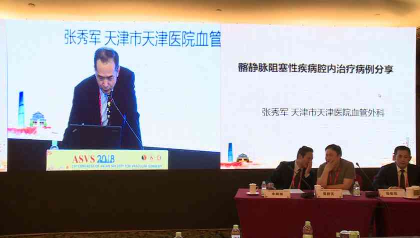 张秀军：髂静脉阻塞性疾病腔内治疗病例分享