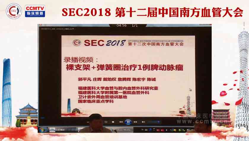 录播视频：裸支架+弹簧圈治疗1例脾动脉瘤