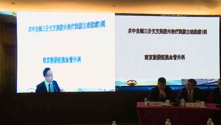 术中自制三分支支架腔内治疗胸腹主动脉瘤1例