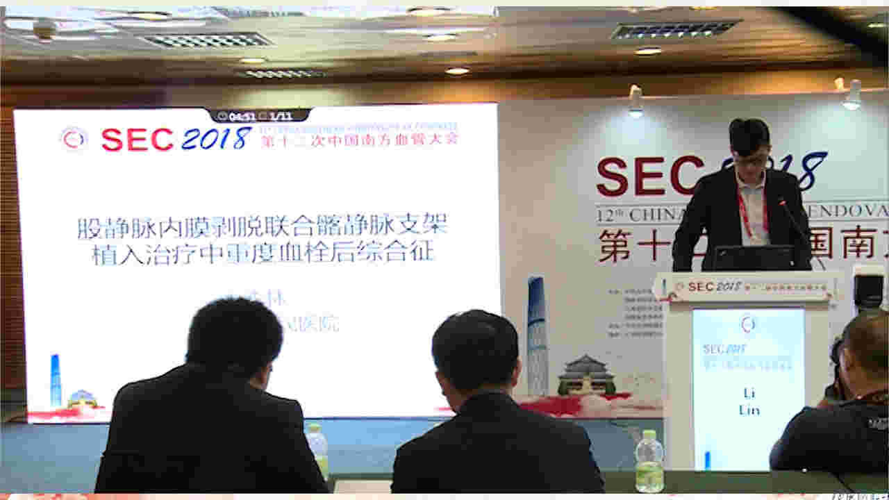 李林：股静脉内膜剥脱联合髂静脉支架植入治疗中重度血栓后综合征