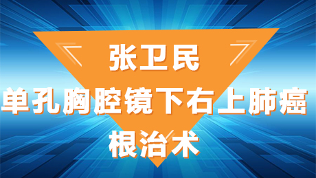 张卫民：单孔胸腔镜下右上肺癌根治术