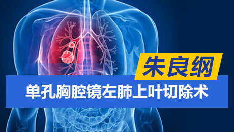 朱良纲：单孔胸腔镜左肺上叶切除术