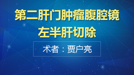 贾户亮：第二肝门肿瘤腹腔镜左半肝切除