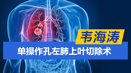韦海涛：单操作孔左肺上叶切除术