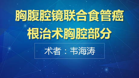 韦海涛：胸腹腔镜联合食管癌根治术胸腔部分