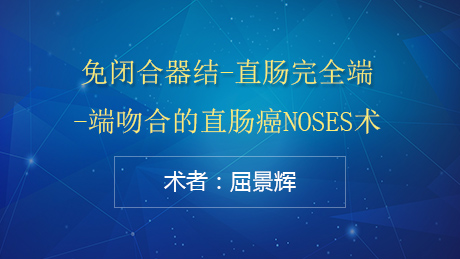 屈景辉：免闭合器结-直肠完全端-端吻合的直肠癌NOSES术