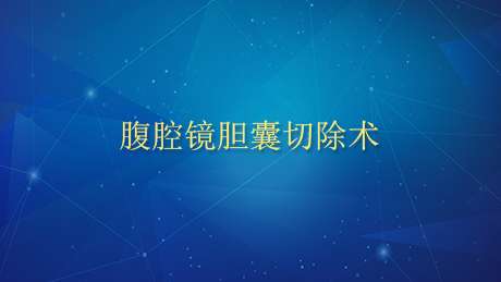 腹腔镜胆囊切除术
