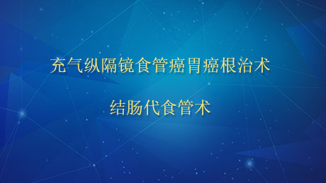 充气纵隔镜食管癌胃癌根治术，结肠代食管术