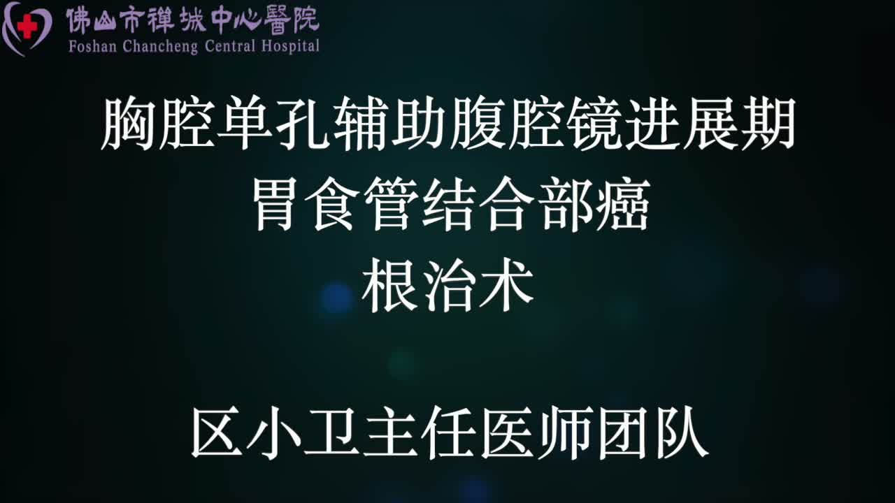 区小卫：经胸单孔辅助腹腔镜食管胃结合部腺癌根治术