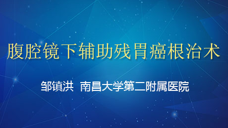 邹镇洪：腹腔镜下辅助残胃癌根治术