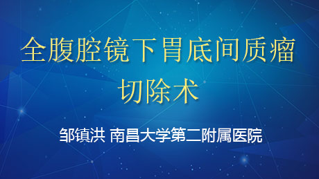 邹镇洪：全腹腔镜下胃底间质瘤切除术