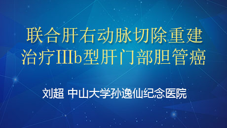 刘超：联合肝右动脉切除重建治疗Ⅲb型肝门部胆管癌