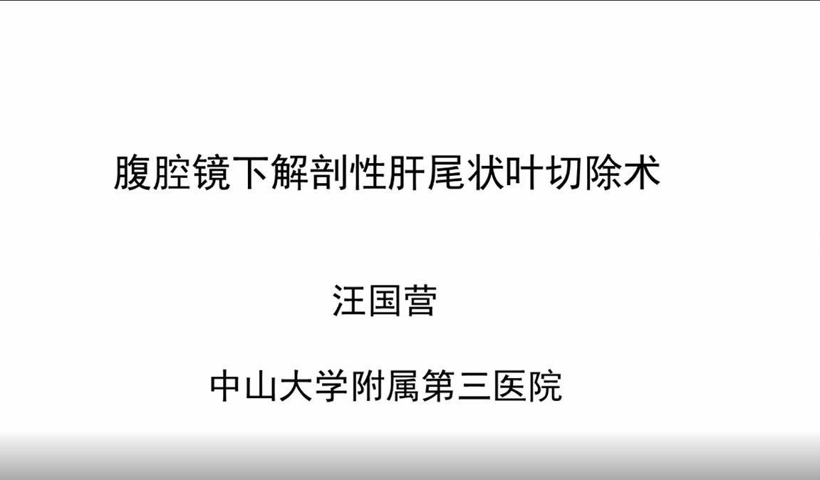 汪国营：腹腔镜下解剖性肝尾状叶切除术