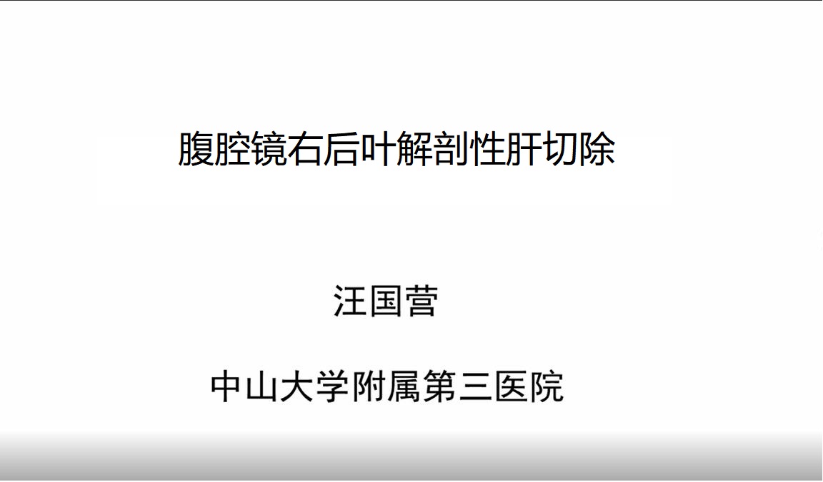 汪国营：腹腔镜右后叶解剖性肝切除术