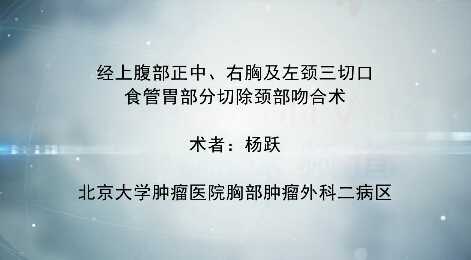 杨跃：经上腹部正中、右胸及左颈三切口食管胃部分切除颈部吻合术