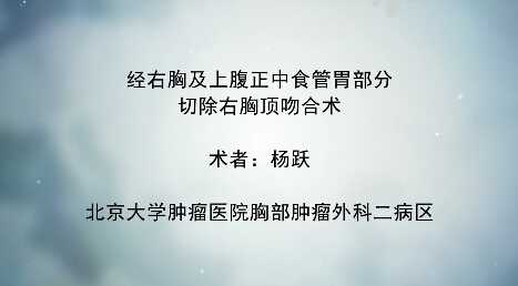 杨跃：经右胸及上腹正中食管胃部分切除＋右胸顶吻合术