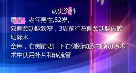 曲乐丰：右侧颈动脉内膜切除术