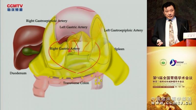 龚建平：胃癌D2根治术联合完整系膜切除