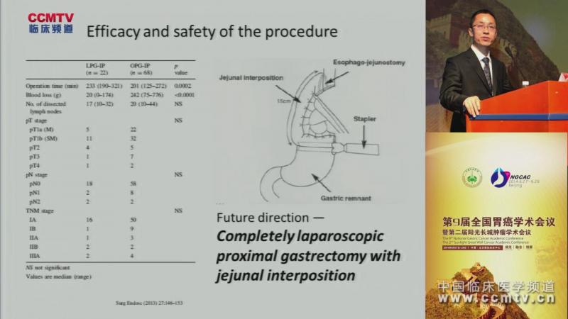 武爱文：腹腔镜近端胃切除淋巴结清扫并空肠间置术