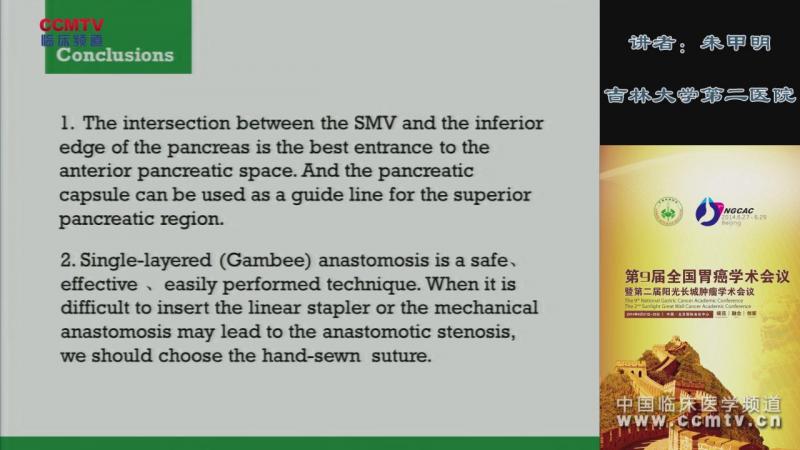 朱甲明：胃癌腹腔镜手术：胰上区和Gambee吻合的入路
