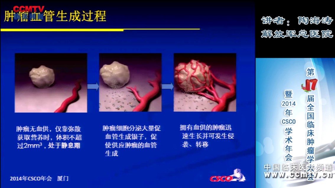 陶海涛：非小细胞肺癌脑转移的化学治疗