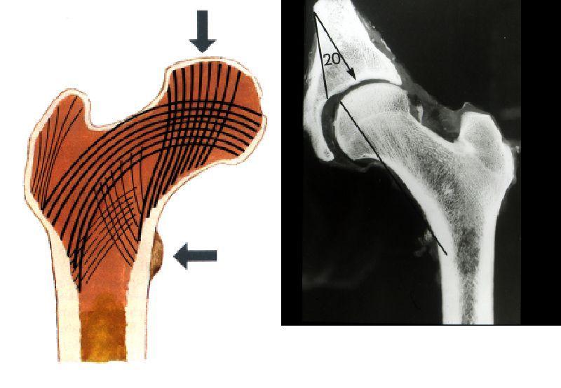 股骨颈骨折解剖图片