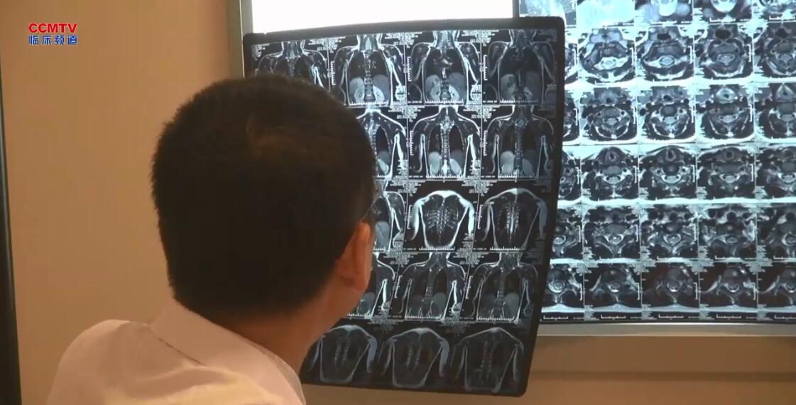 北京协和医院：先天性脊柱侧弯半椎体畸形