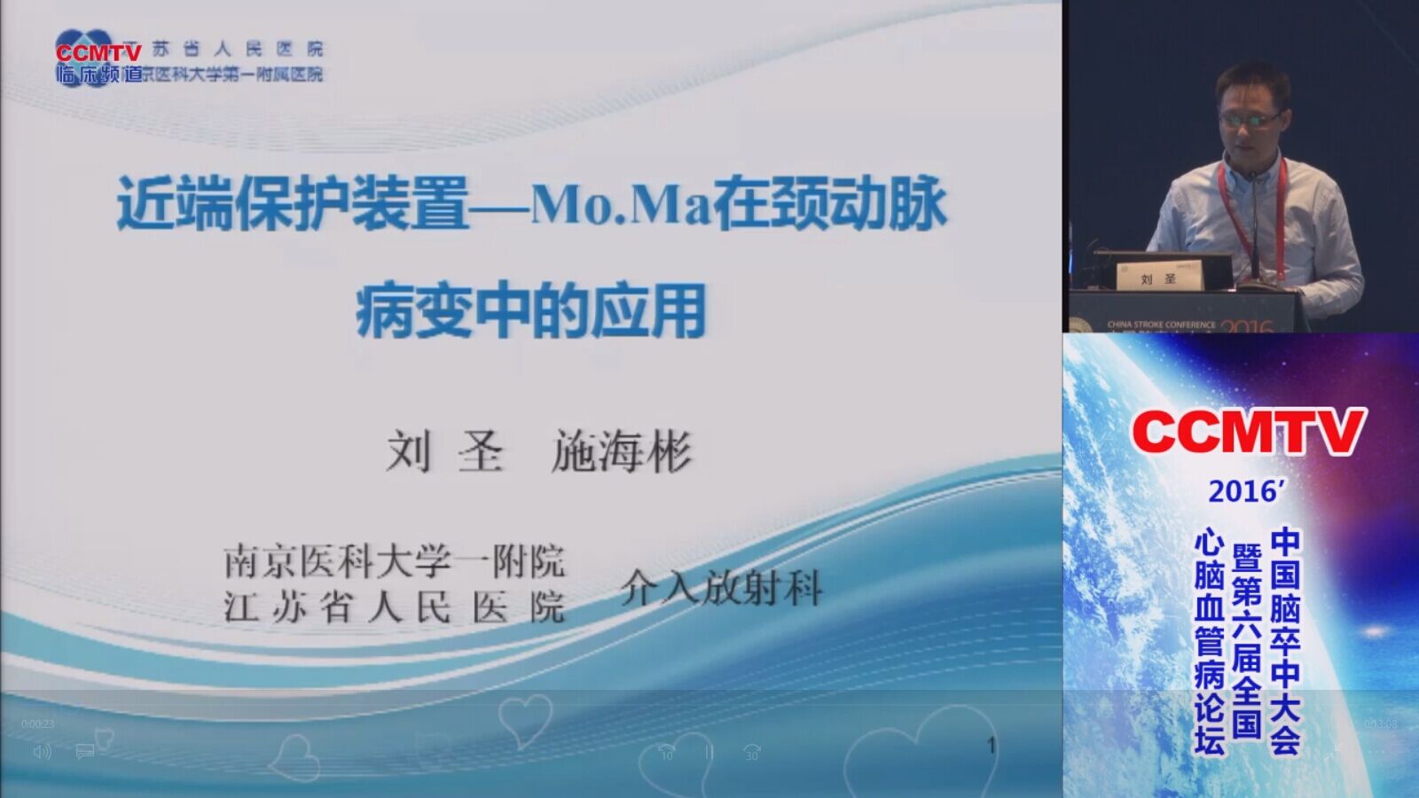 刘圣：近端保护装置—Mo.Ma在颈动脉病变中的应用