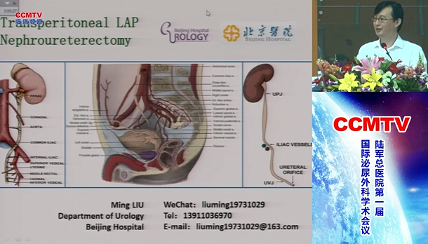刘明：经腹途径腹腔镜肾输尿管全长切除输尿管下段处理解剖
