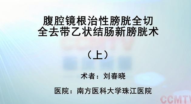 刘春晓：腹腔镜根治性膀胱全切全去带乙状结肠新膀胱术的（上）