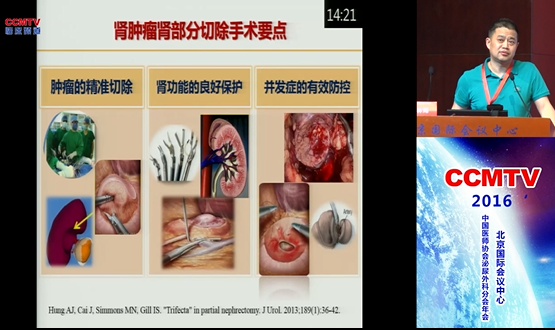 王林辉：腹腔镜肾部分切除手术要点分享