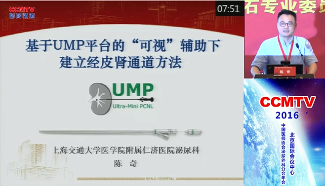 陈奇：基于UMP平台的”可视“辅助下建立经皮肾通道方法