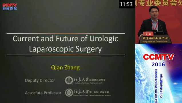 张骞：机器人时代腹腔镜技术的现状与将来的思考