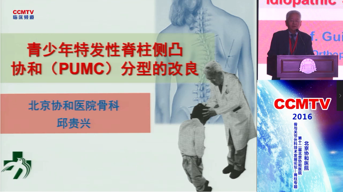 邱贵兴：青少年特发性脊柱侧凸协和（PUMC）分型的改良